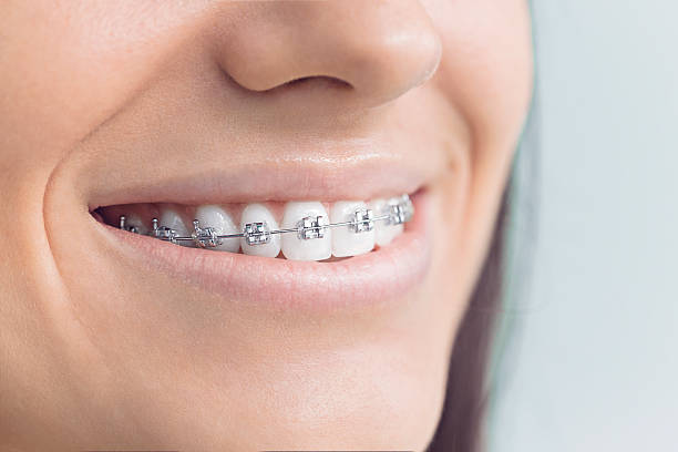 Best Full Mouth Reconstruction  in East Camden, SC